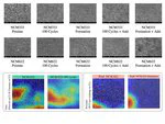 Bridging data-rich and data-poor domains on Lithium-Ion Battery via Scanning Electron Microscopic data through Convolutional Neural Network Transfer Learning